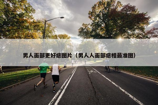 男人面部更好痣图片（男人人面部痣相最准图）